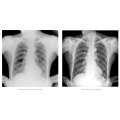 Équipement d&#39;angiographie radiographique multifonctionnel pour radiographie et Fluorosocpy haute fréquence avec CE